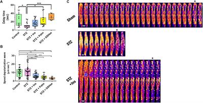 Diabetes Increases the Vulnerability of the Cardiac Mitochondrial Network to Criticality